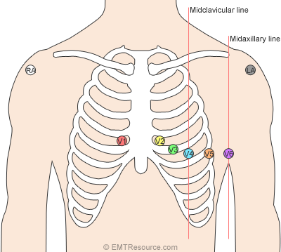 12 lead ecg placement mnemonic